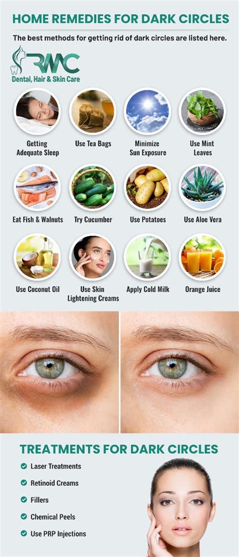 The Ultimate Guide to Natural Remedies for Under-Eye Circles